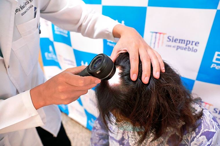 EsSalud: 60% caída del cabello tras sufrir covid-19